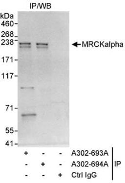 Detection of human MRCKalpha by western blot of immunoprecipitates.