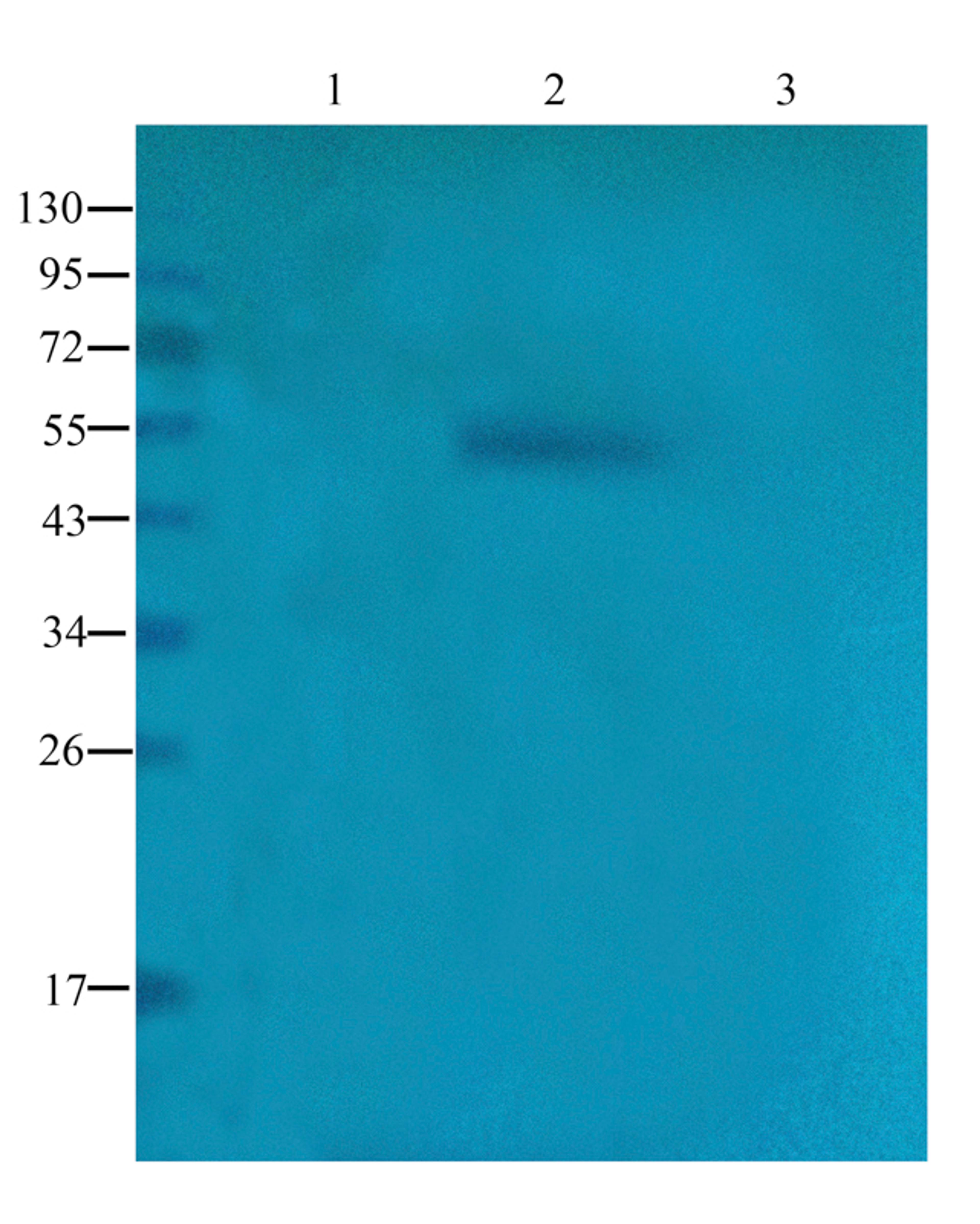 WB analysis of human thyroid tumor (lane 1), human breast cancer (lane 2), human thyroid cancer (lane 3) using CD20 antibody (1 ug/ml)