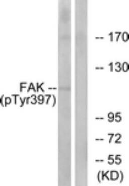 Western Blot: FAK [p Tyr397] Antibody [NBP1-60837] - Analysis of extracts from 293 cells treated with EGF 200ng/ml 30', using FAK (Phospho-Tyr397) Antibody. The lane on the right is treated with the synthesized peptide.