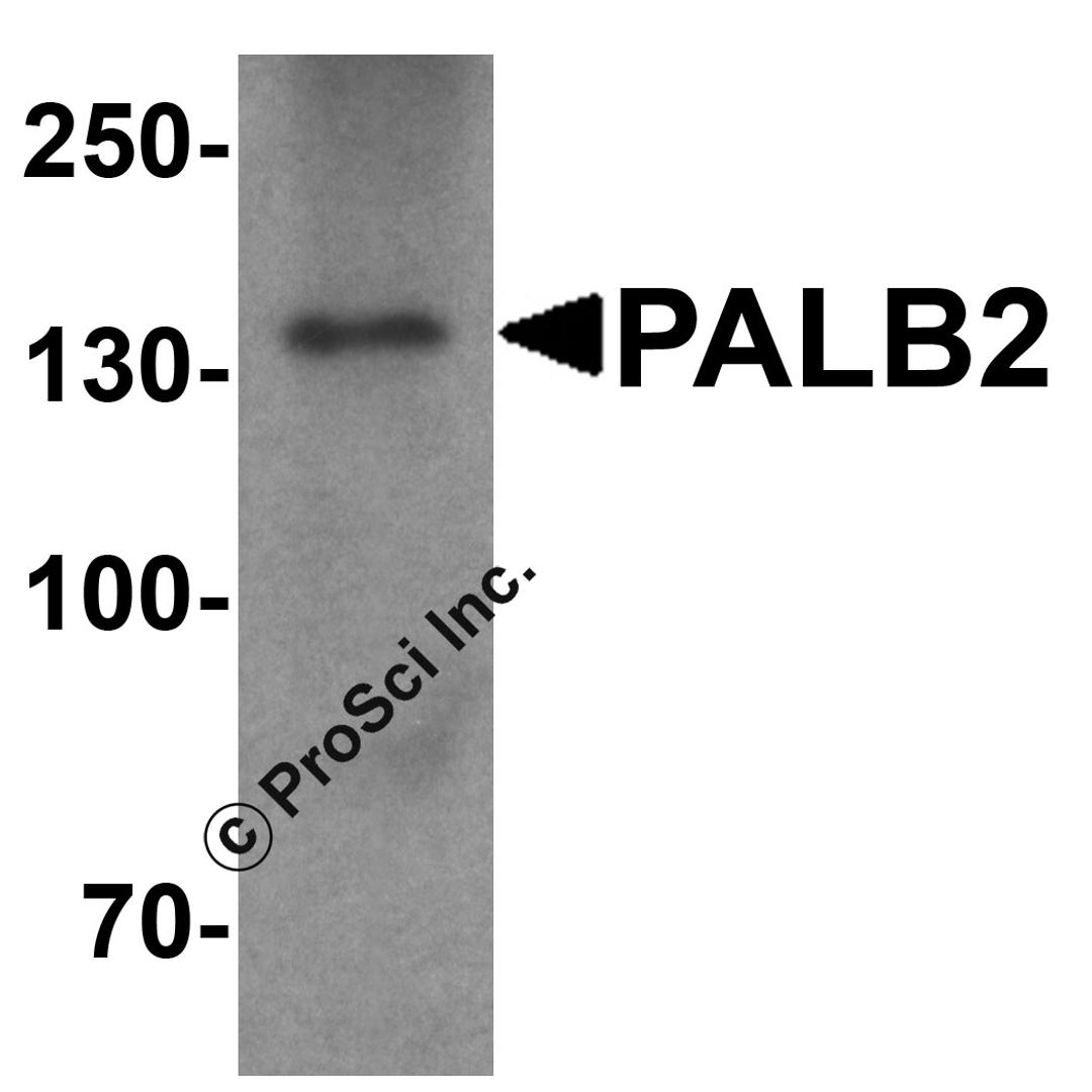 Western blot analysis of PALB2 in SK-N-SH cell lysate with PALB2 antibody at 1 μg/mL.