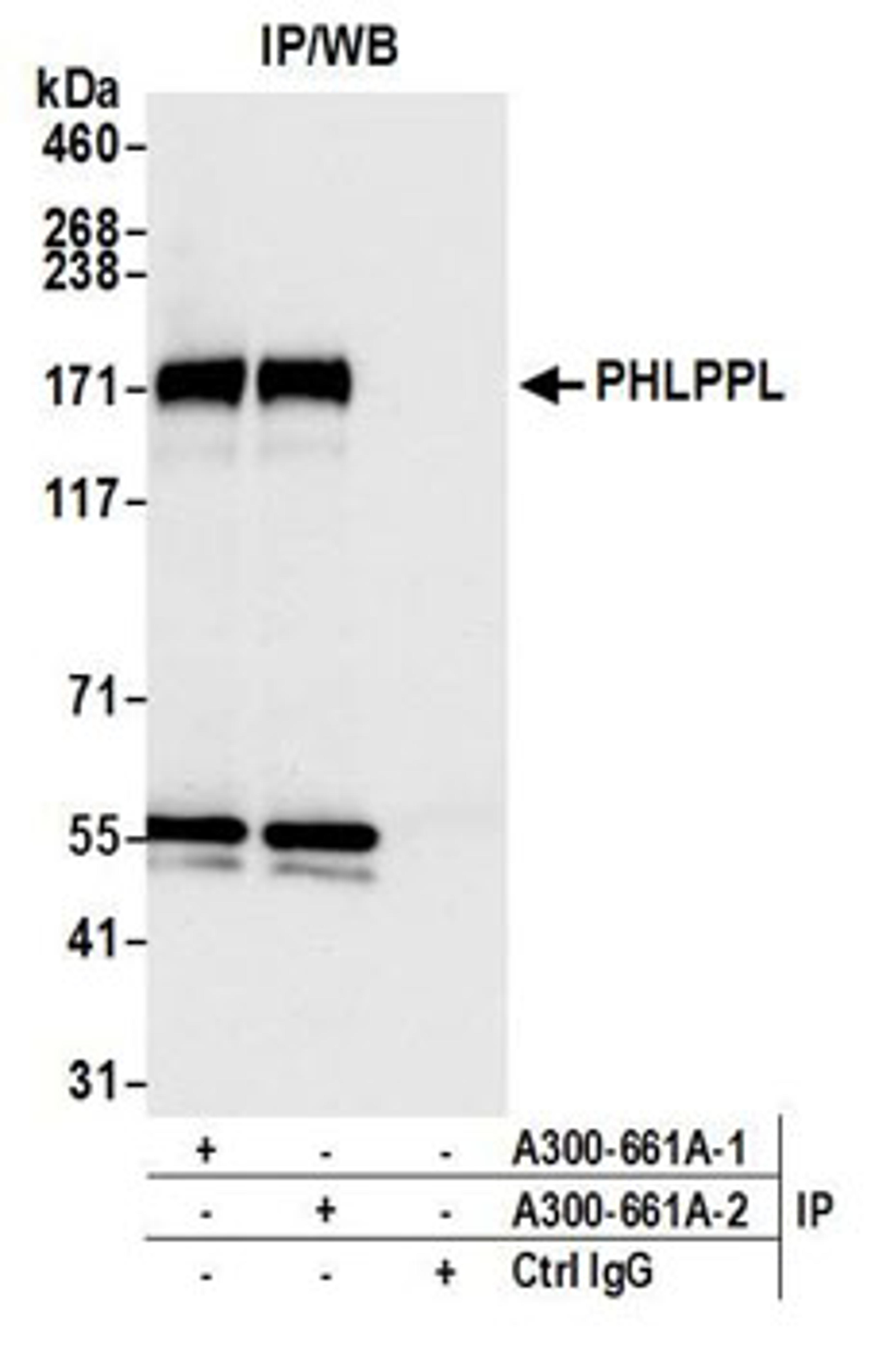 Detection of human PHLPPL by western blot of immunoprecipitates.