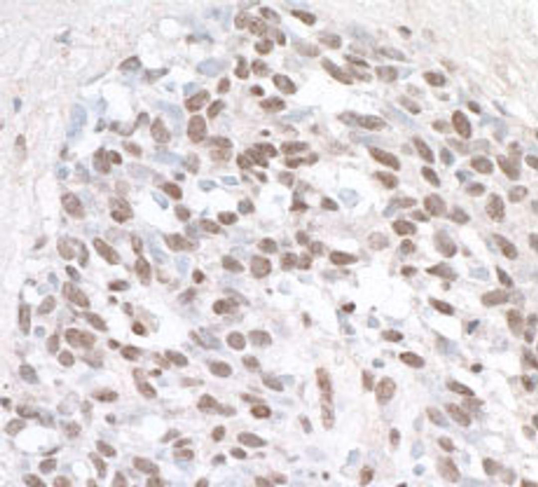 Detection of human ZHX1 by immunohistochemistry.