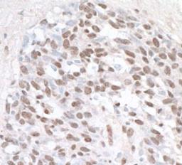 Detection of human ZHX1 by immunohistochemistry.