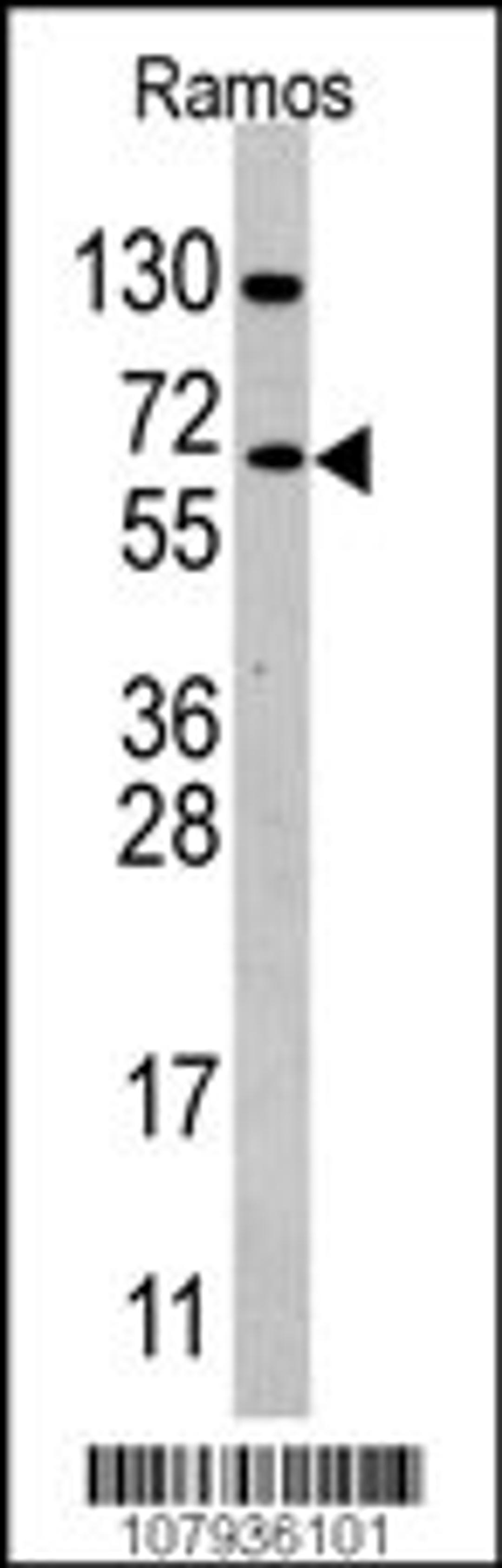 Western Blot in Ramos cell line lysates (35ug/lane). CDC25B(arrow) was detected using the purified Pab.