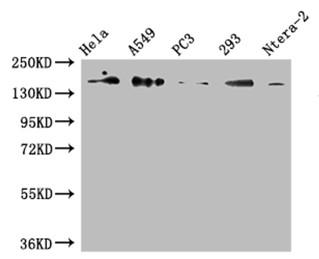 Western Blot. Positive WB detected in: Hela whole cell lysate, A549 whole cell lysate, PC3 whole cell lysate, 293 whole cell lysate, Ntera-2 whole cell lysate. All lanes: DUOX2 antibody at 1:500. Secondary. Goat polyclonal to rabbit IgG at 1/50000 dilution. Predicted band size: 176 kDa. Observed band size: 176 kDa. 