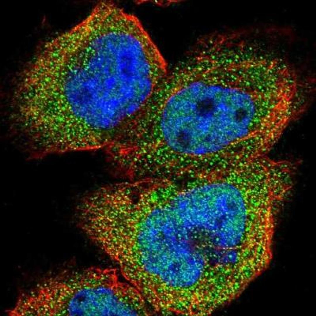 Immunocytochemistry/Immunofluorescence: TRPM1 Antibody [NBP1-81284] - Staining of human cell line A-431 shows positivity in nucleus but not nucleoli & cytoplasm.