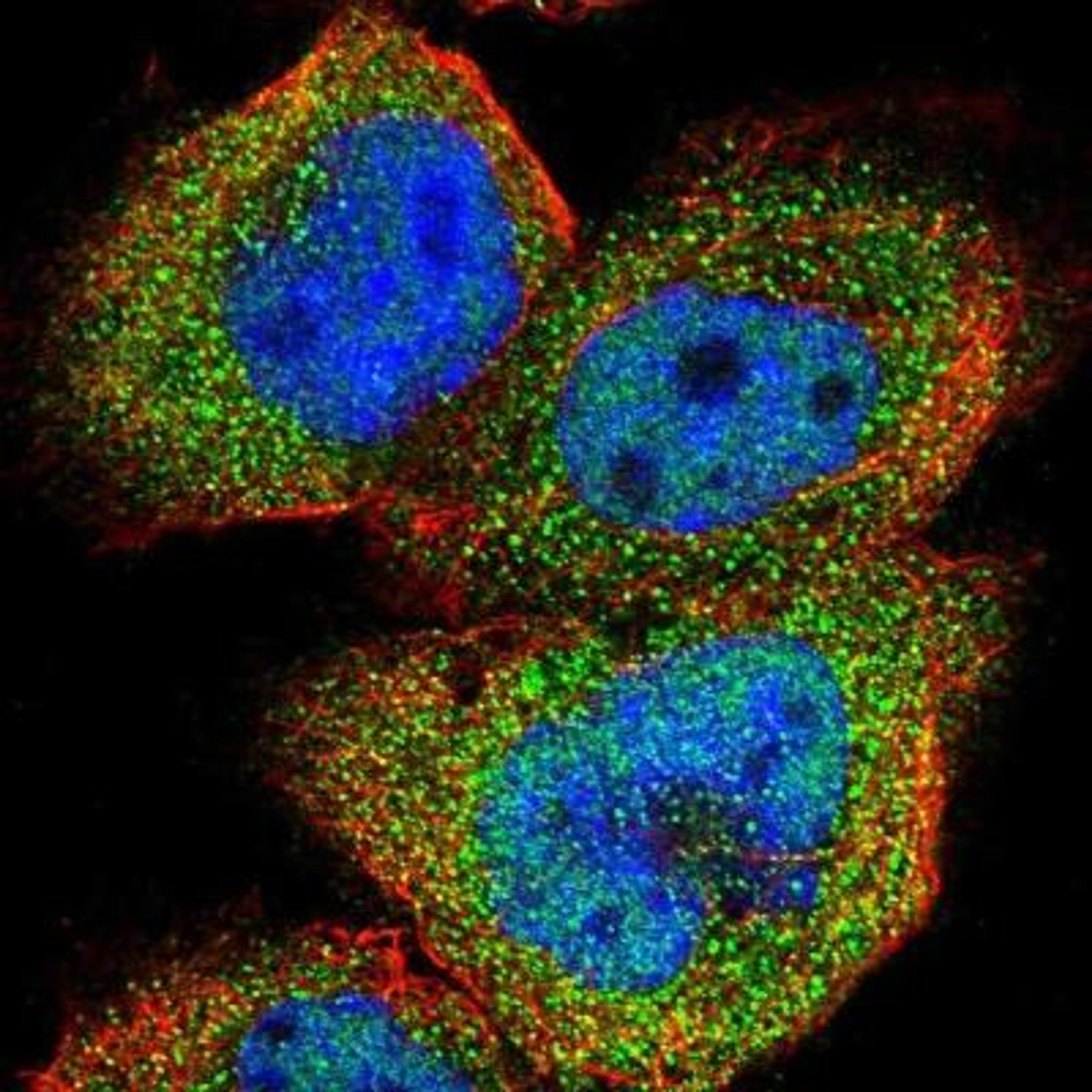 Immunocytochemistry/Immunofluorescence: TRPM1 Antibody [NBP1-81284] - Staining of human cell line A-431 shows positivity in nucleus but not nucleoli & cytoplasm.