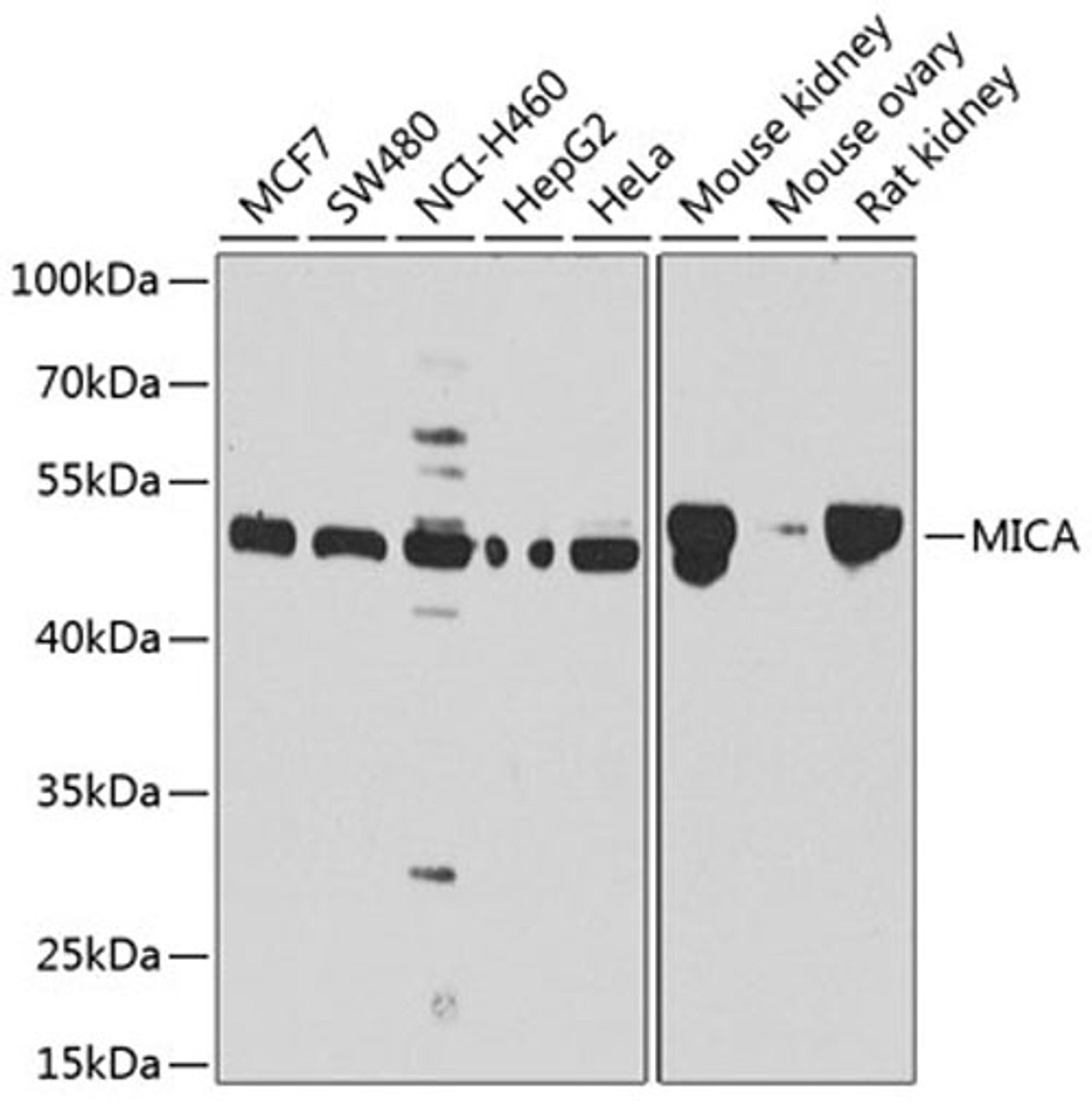 Western blot - MICA antibody (A1390)