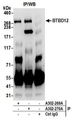 Detection of human BTBD12 by western blot of immunoprecipitates.