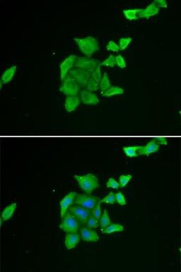 Immunofluorescense analysis of U2OS cell using TUSC2 antibody