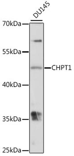 Western blot - CHPT1 antibody (A16137)