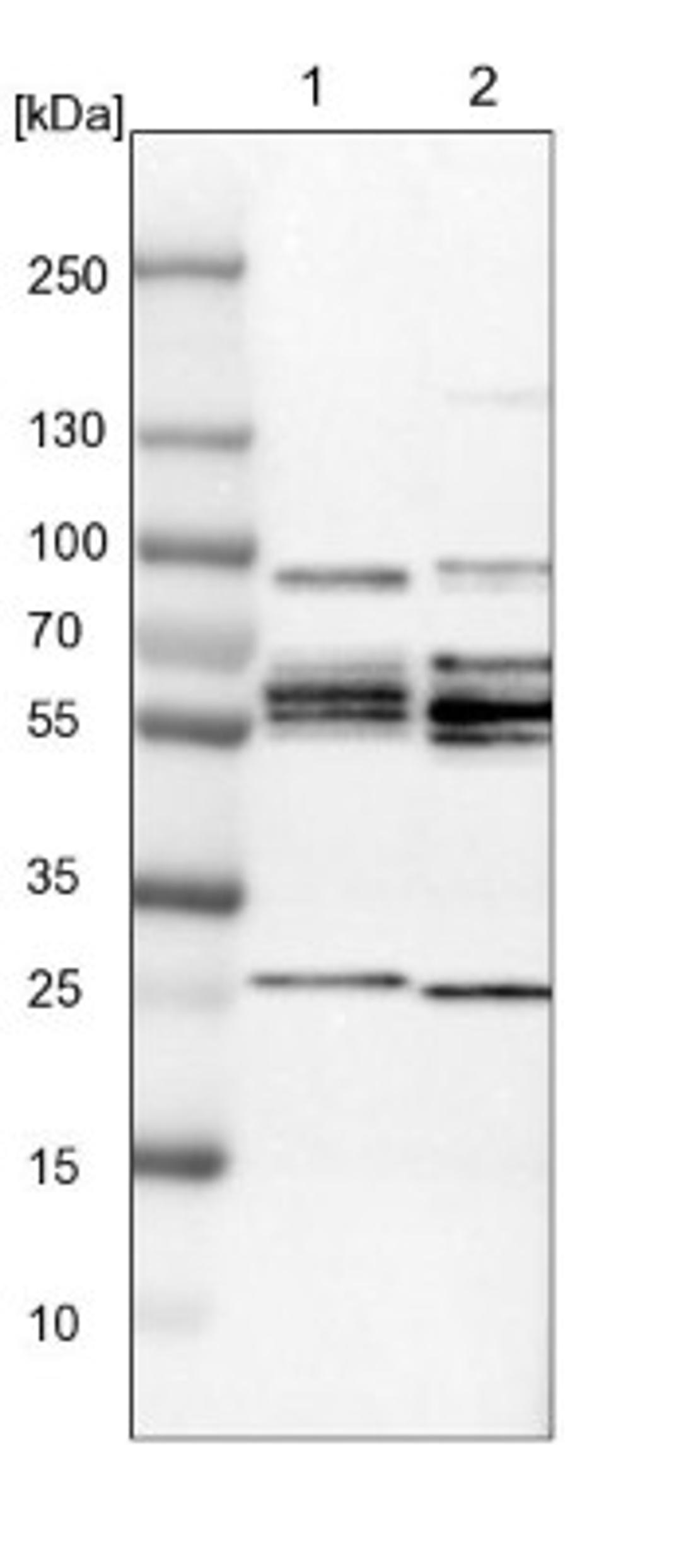 Western Blot: KIAA1045 Antibody [NBP1-90937] - Lane 1: NIH-3T3 cell lysate (Mouse embryonic fibroblast cells)<br/>Lane 2: NBT-II cell lysate (Rat Wistar bladder tumour cells)