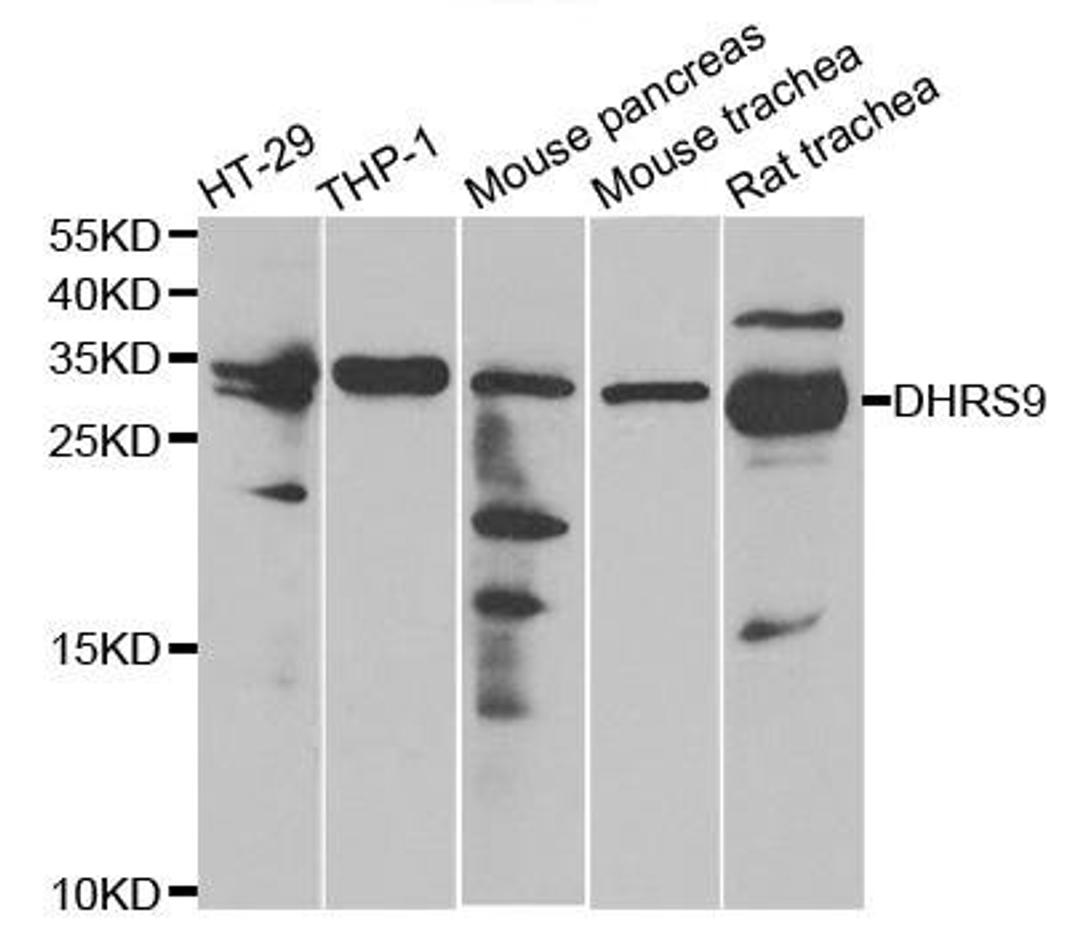 Western blot analysis of extracts of various cell lines using DHRS9 antibody