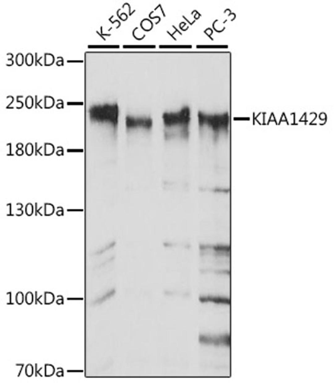 Western blot - KIAA1429 antibody (A16201)