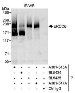 Detection of human ERCC6 by western blot of immunoprecipitates.