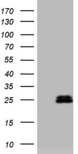 Western Blot: AMTN Antibody (2D9) [NBP2-46517] - Analysis of HEK293T cells were transfected with the pCMV6-ENTRY control (Left lane) or pCMV6-ENTRY AMTN.