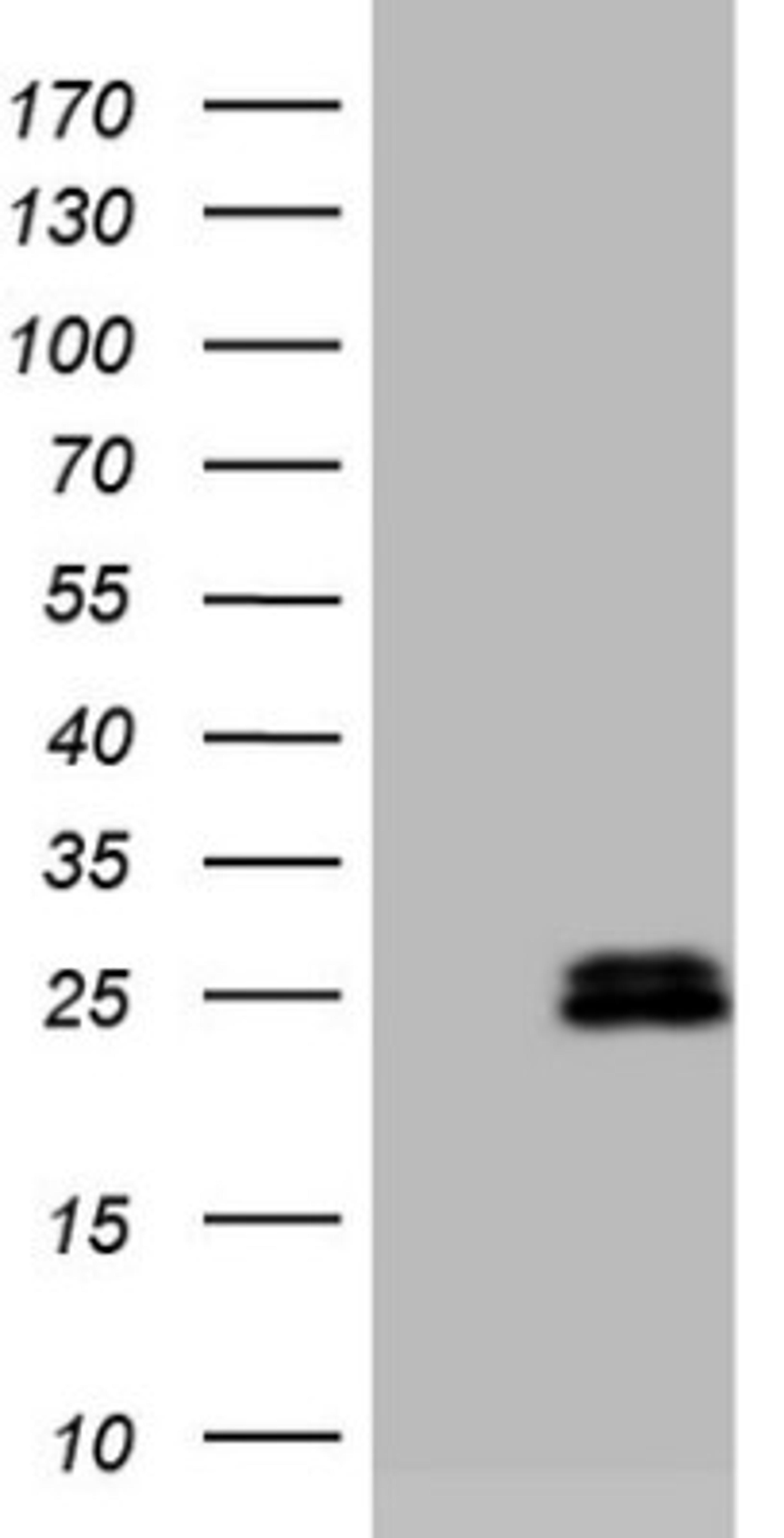 Western Blot: AMTN Antibody (2D9) [NBP2-46517] - Analysis of HEK293T cells were transfected with the pCMV6-ENTRY control (Left lane) or pCMV6-ENTRY AMTN.