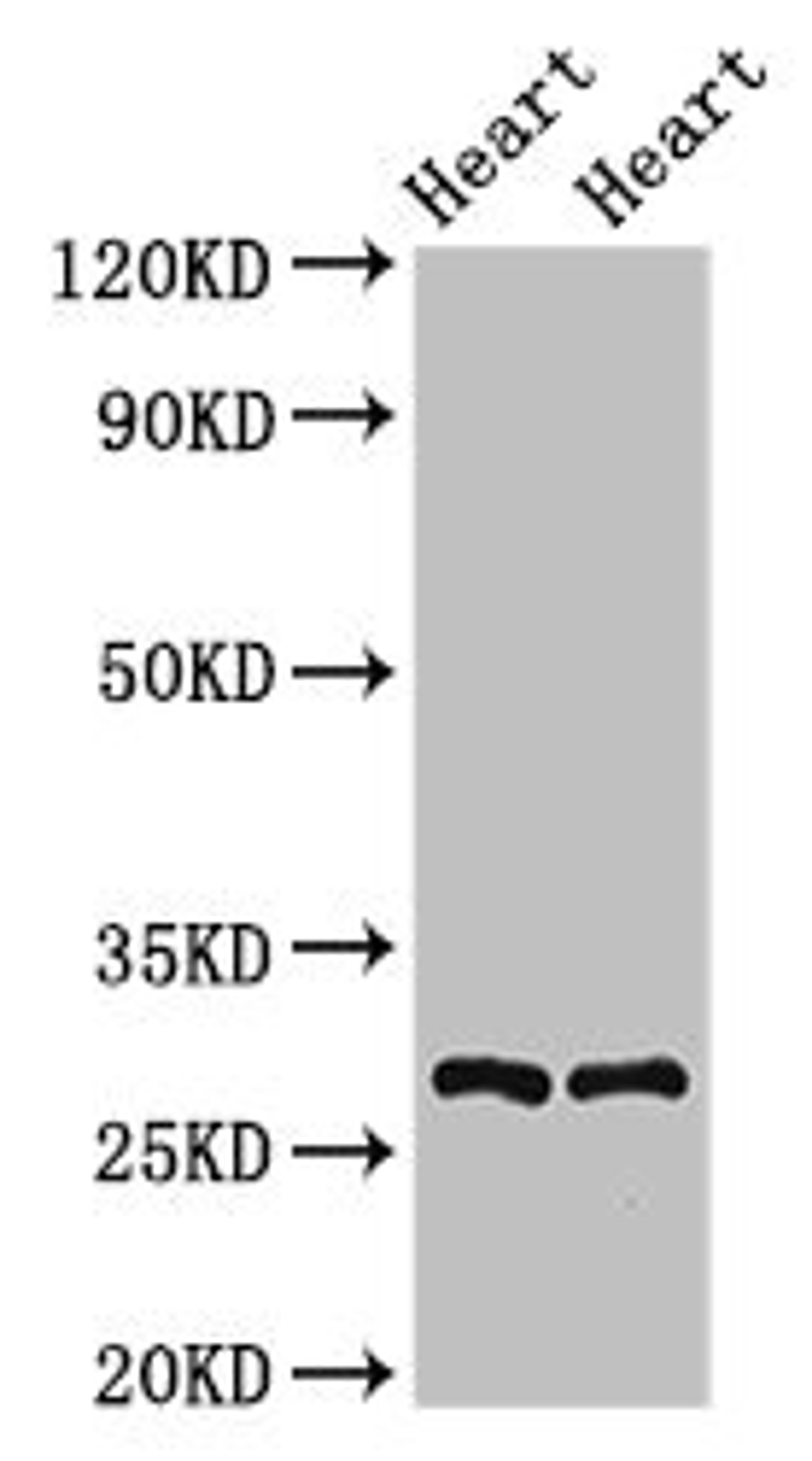 Western Blot. Positive WB detected in: Rat heart tissue, Mouse heart tissue. All lanes: MYF5 antibody at 2.5ug/ml. Secondary. Goat polyclonal to rabbit IgG at 1/50000 dilution. Predicted band size: 29 kDa. Observed band size: 29 kDa. 