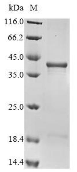 (Tris-Glycine gel) Discontinuous SDS-PAGE (reduced) with 5% enrichment gel and 15% separation gel.