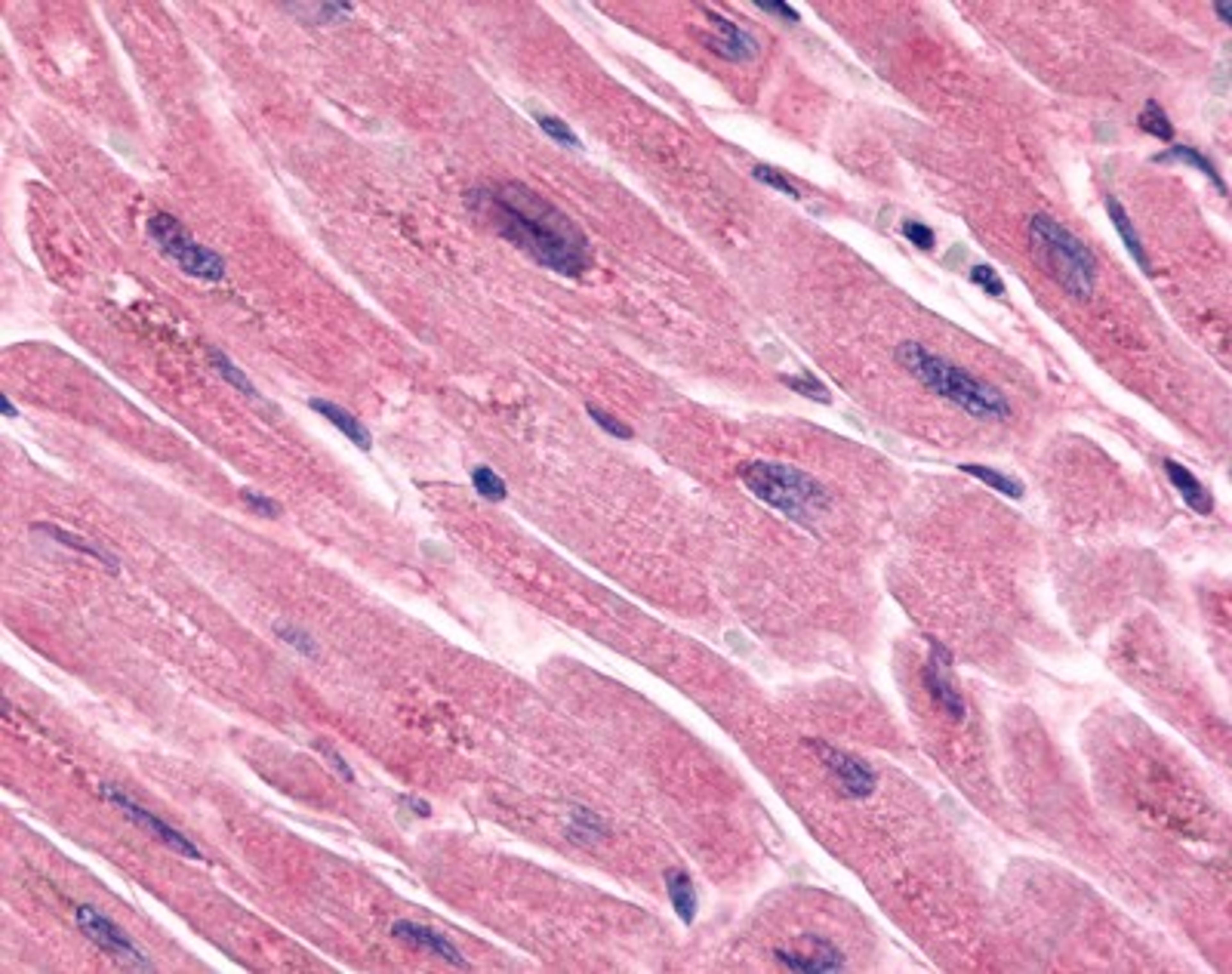 Immunohistochemistry-Paraffin: Frizzled-7 Antibody [NLS4900] - Analysis of anti-FZD7 / Frizzled 7 antibody with human heart, cardiac myocytes.