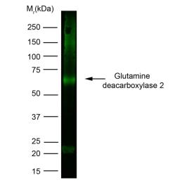 Human brain lysate probed with Mouse anti Human Glutamine Decarboxylase 2