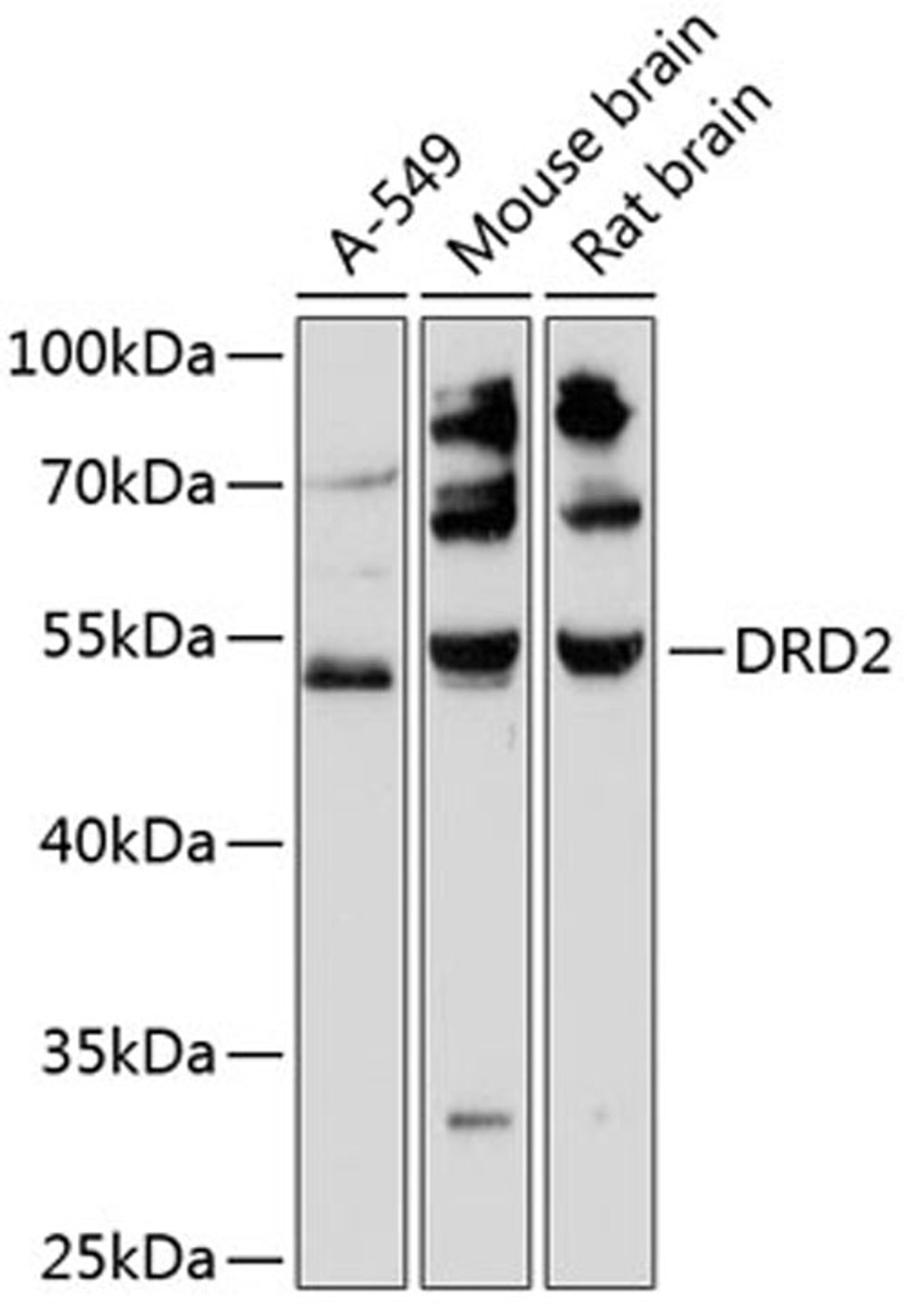 Western blot - DRD2 antibody (A12930)