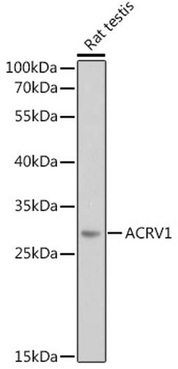 Western blot - ACRV1 antibody (A8098)