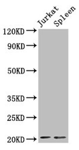 Western Blot. Positive WB detected in: Jurkat whole cell lysate, Rat spleen tissue. All lanes: H1F0 antibody at 1.5µg/ml. Secondary. Goat polyclonal to rabbit IgG at 1/50000 dilution. Predicted band size: 21, 20 kDa. Observed band size: 21 kDa