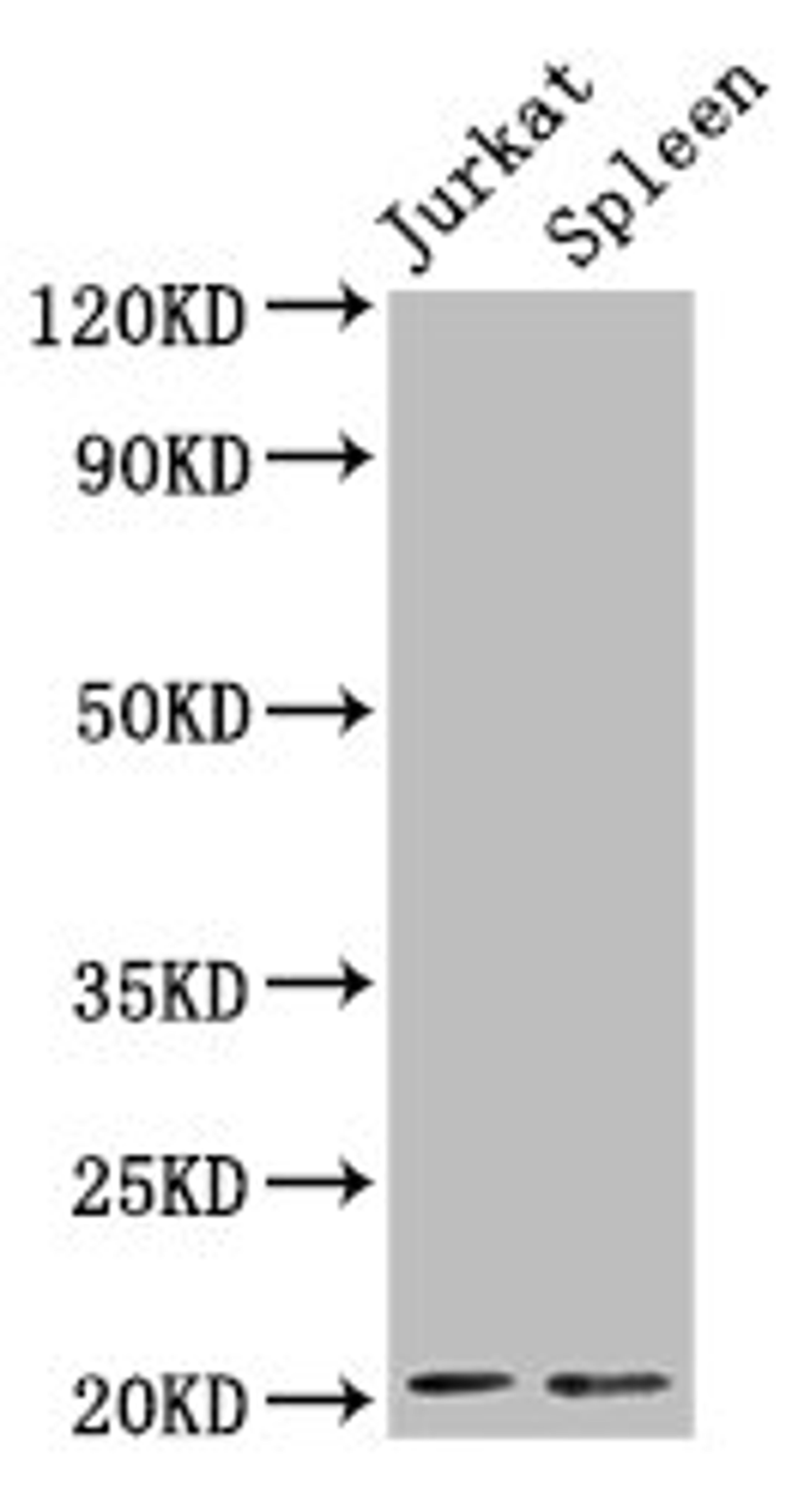 Western Blot. Positive WB detected in: Jurkat whole cell lysate, Rat spleen tissue. All lanes: H1F0 antibody at 1.5µg/ml. Secondary. Goat polyclonal to rabbit IgG at 1/50000 dilution. Predicted band size: 21, 20 kDa. Observed band size: 21 kDa