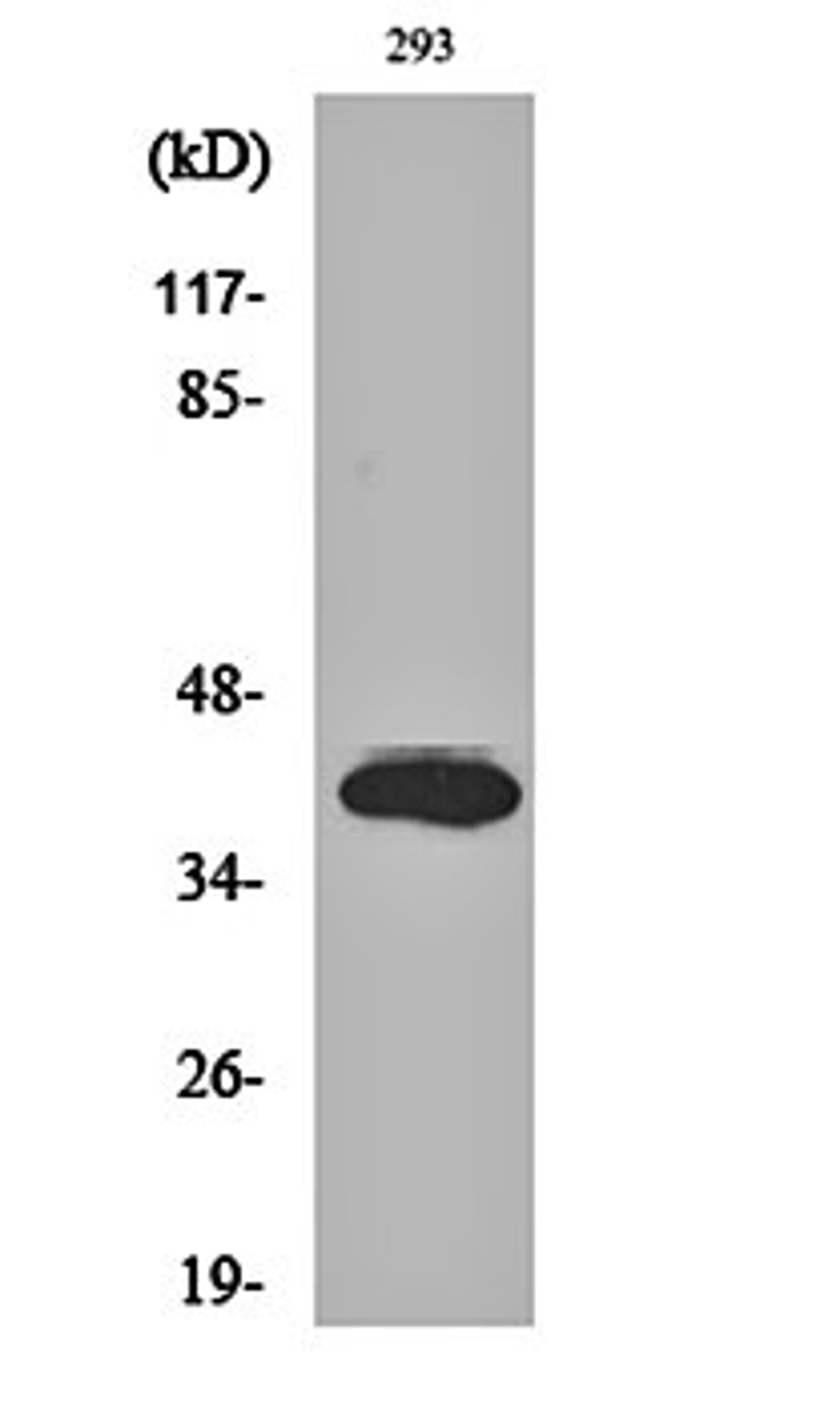 Western blot analysis of 293 cell lysates using Islet-2 antibody