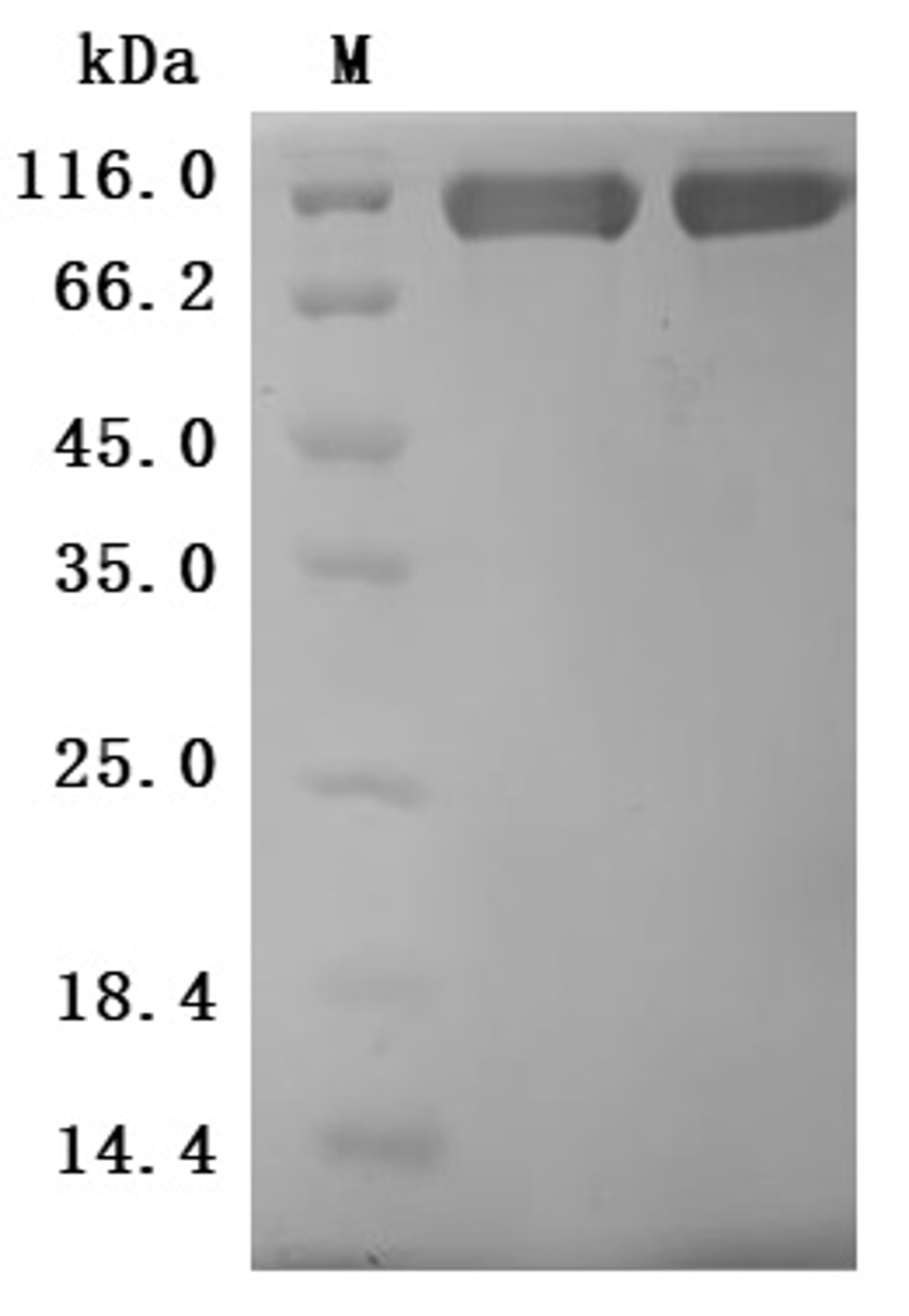 (Tris-Glycine gel) Discontinuous SDS-PAGE (reduced) with 5% enrichment gel and 15% separation gel.