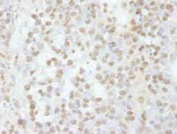 Detection of mouse RBM16 by immunohistochemistry.