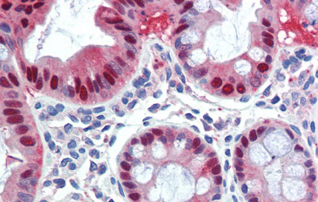 Antibody used in IHC on Human Colon at 5.0 ug/ml.