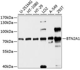 Western blot - BTN2A1 antibody (A10418)