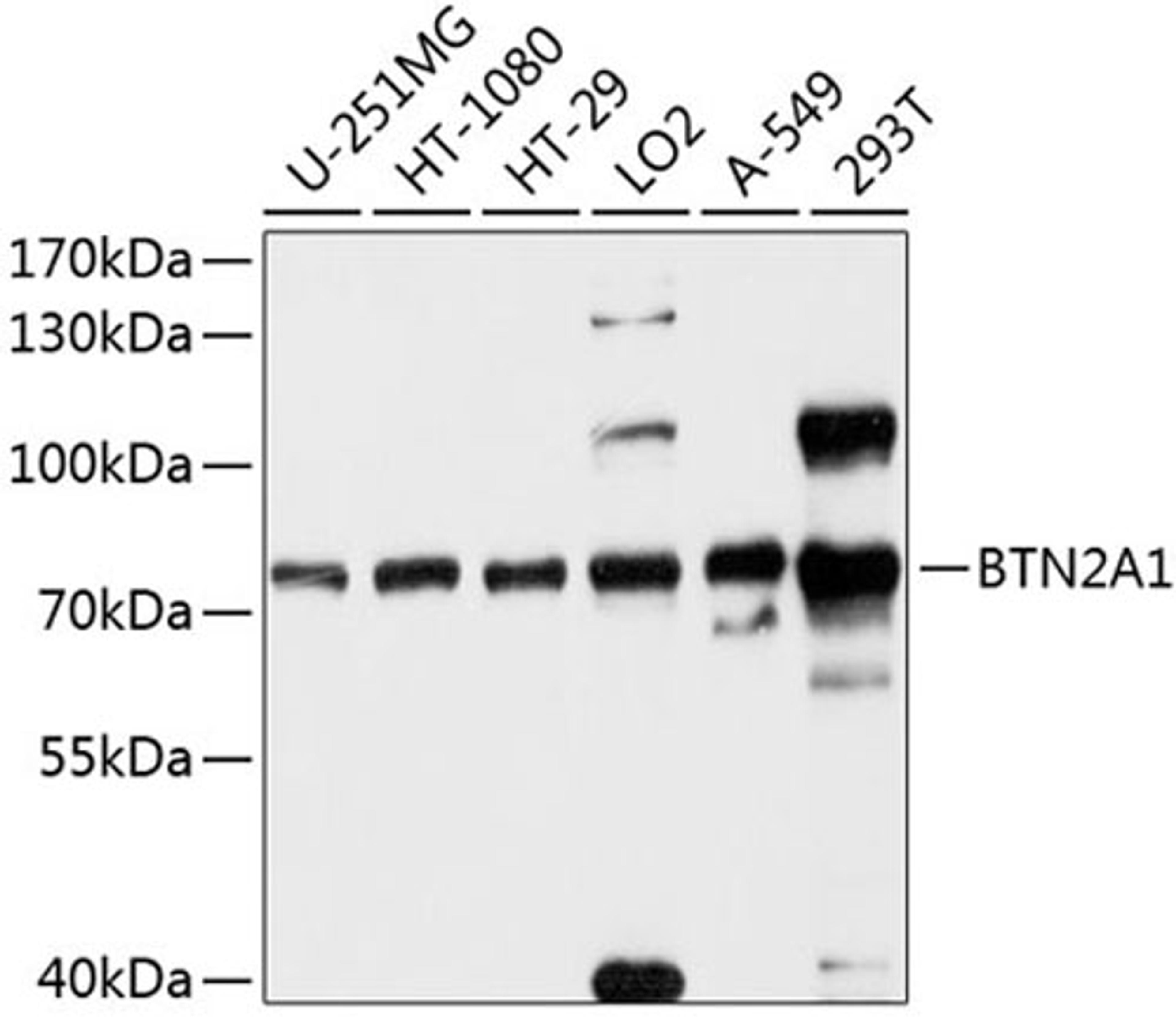 Western blot - BTN2A1 antibody (A10418)