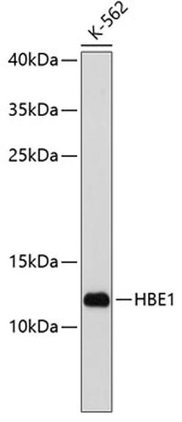 Western blot - HBE1 antibody (A3909)