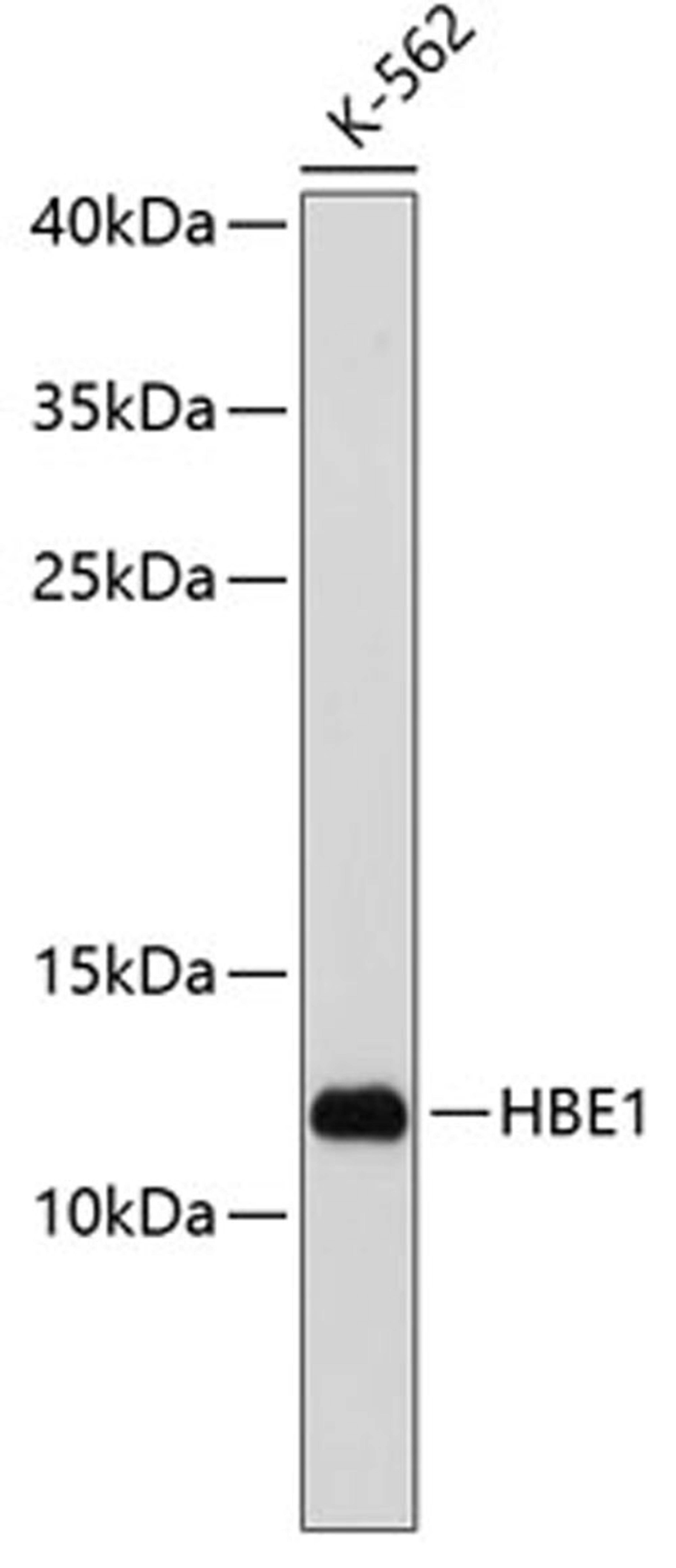 Western blot - HBE1 antibody (A3909)