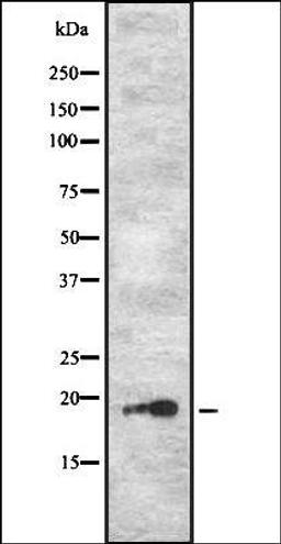 Western blot analysis of HL-60 cell lysate using PJCG2 antibody