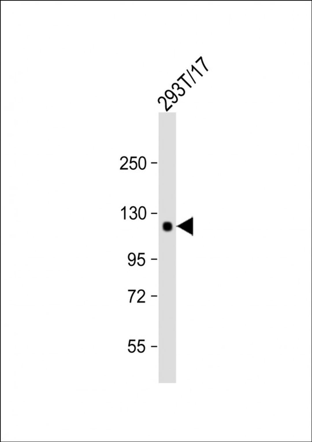 Western Blot at 1:1000 dilution + 293T/17 whole cell lysate Lysates/proteins at 20 ug per lane.