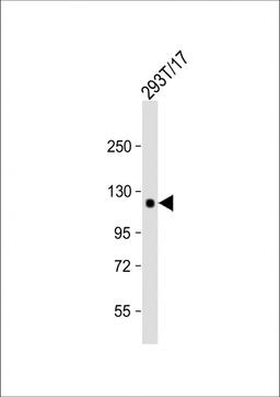 Western Blot at 1:1000 dilution + 293T/17 whole cell lysate Lysates/proteins at 20 ug per lane.