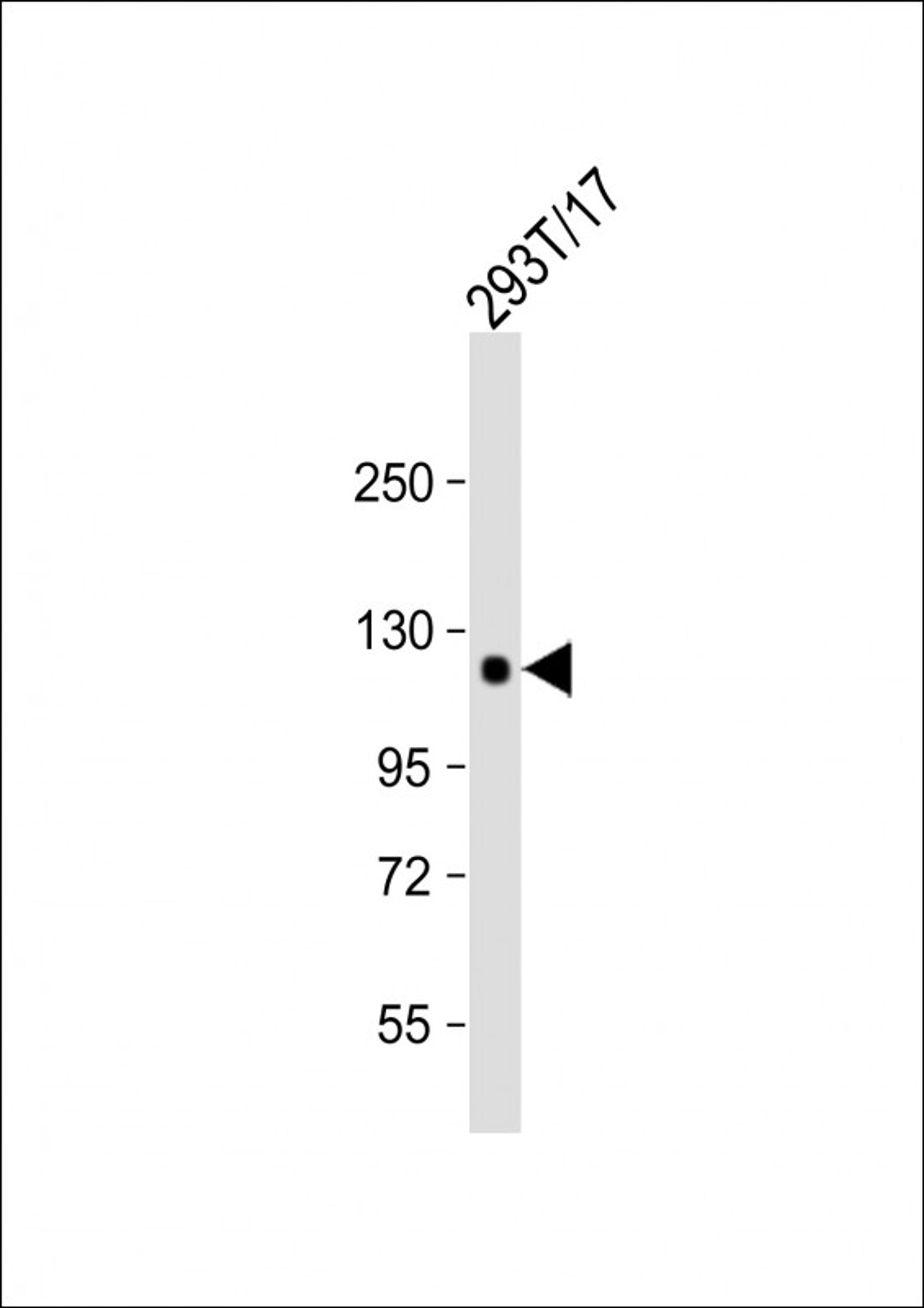 Western Blot at 1:1000 dilution + 293T/17 whole cell lysate Lysates/proteins at 20 ug per lane.