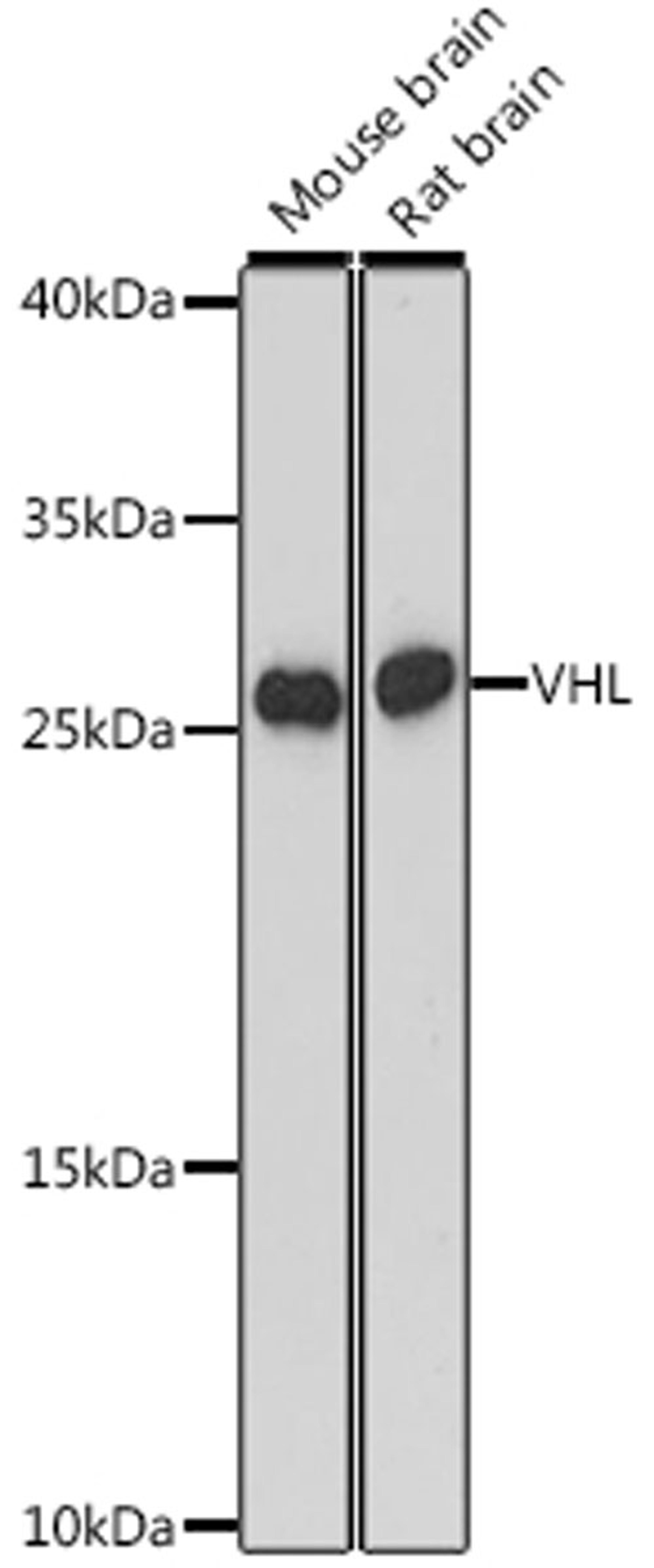 Western blot - VHL antibody (A16287)