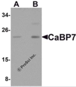 Western blot analysis of CaBP7 in Hela cell lysate with CaBP7 antibody at (A) 1 and (B) 2 &#956;g/mL.