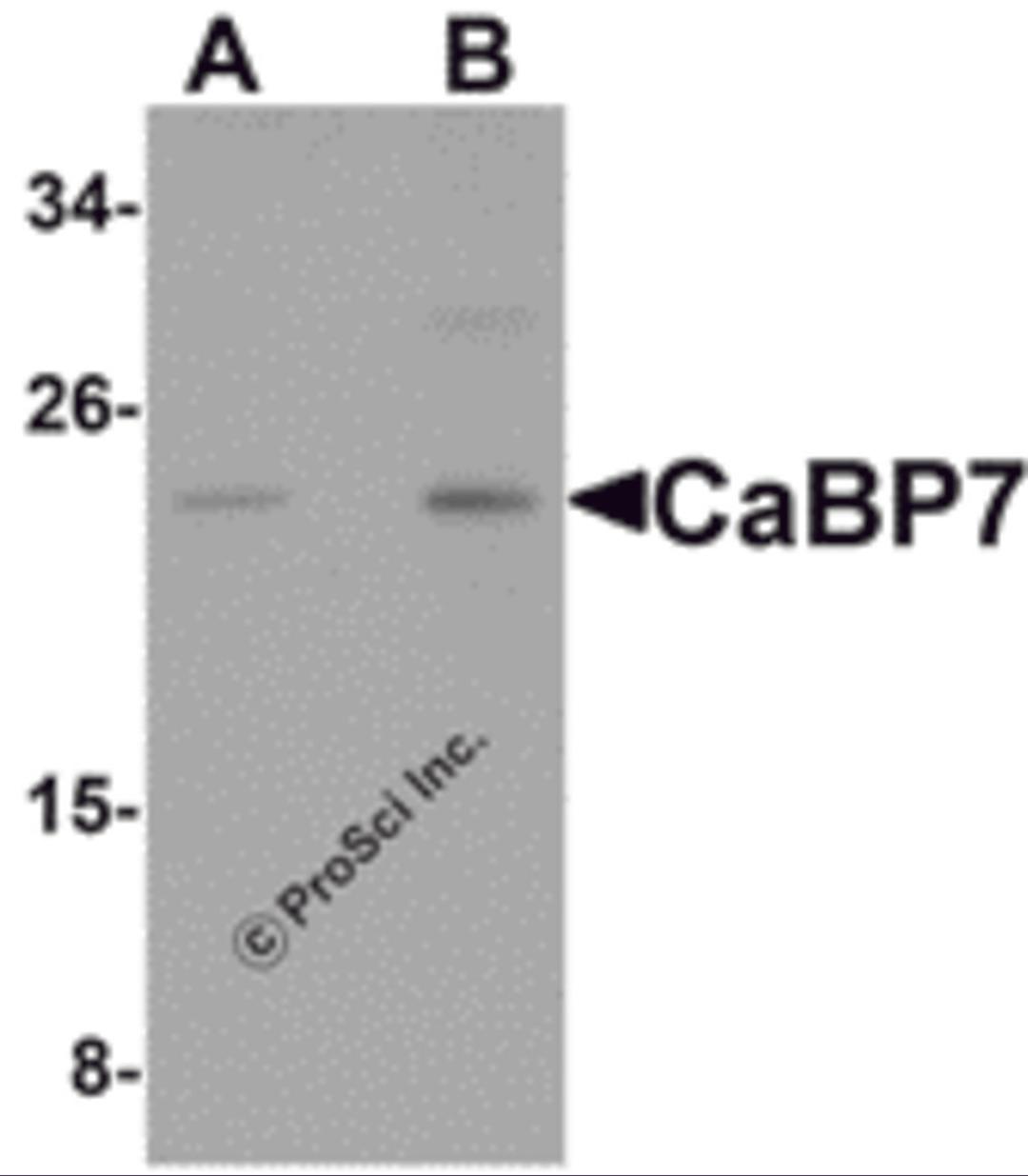 Western blot analysis of CaBP7 in Hela cell lysate with CaBP7 antibody at (A) 1 and (B) 2 μg/mL.
