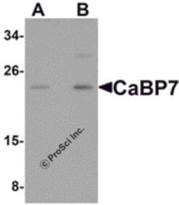 Western blot analysis of CaBP7 in Hela cell lysate with CaBP7 antibody at (A) 1 and (B) 2 μg/mL.