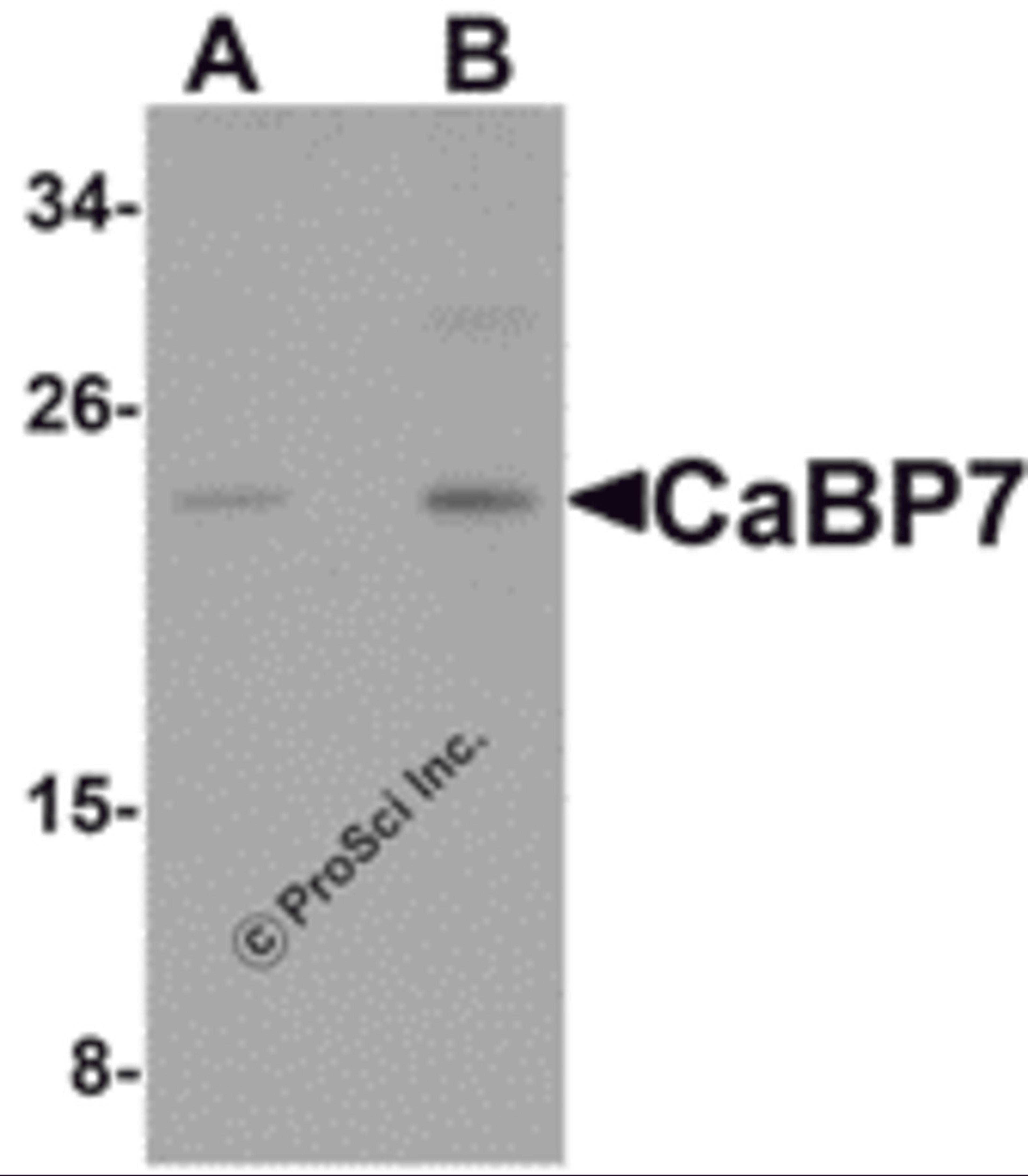 Western blot analysis of CaBP7 in Hela cell lysate with CaBP7 antibody at (A) 1 and (B) 2 μg/mL.