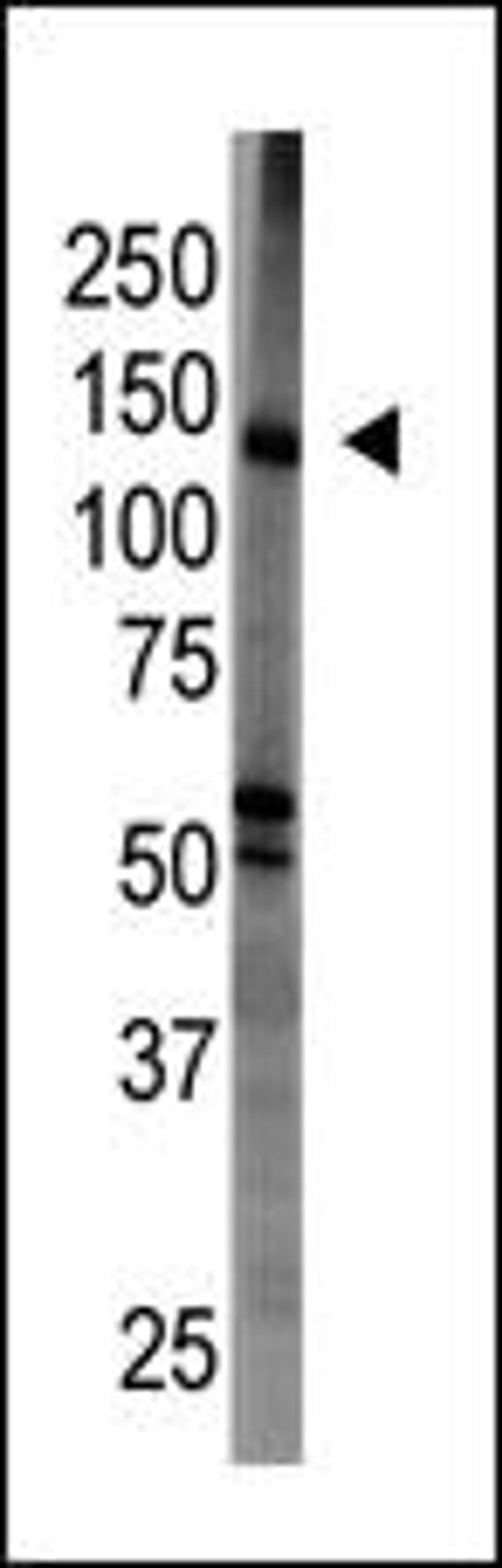 Antibody is used in Western blot to detect BAIAP1 in mouse brain tissue lysate.