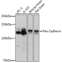 Western blot - Pan Cadherin antibody (A18682)