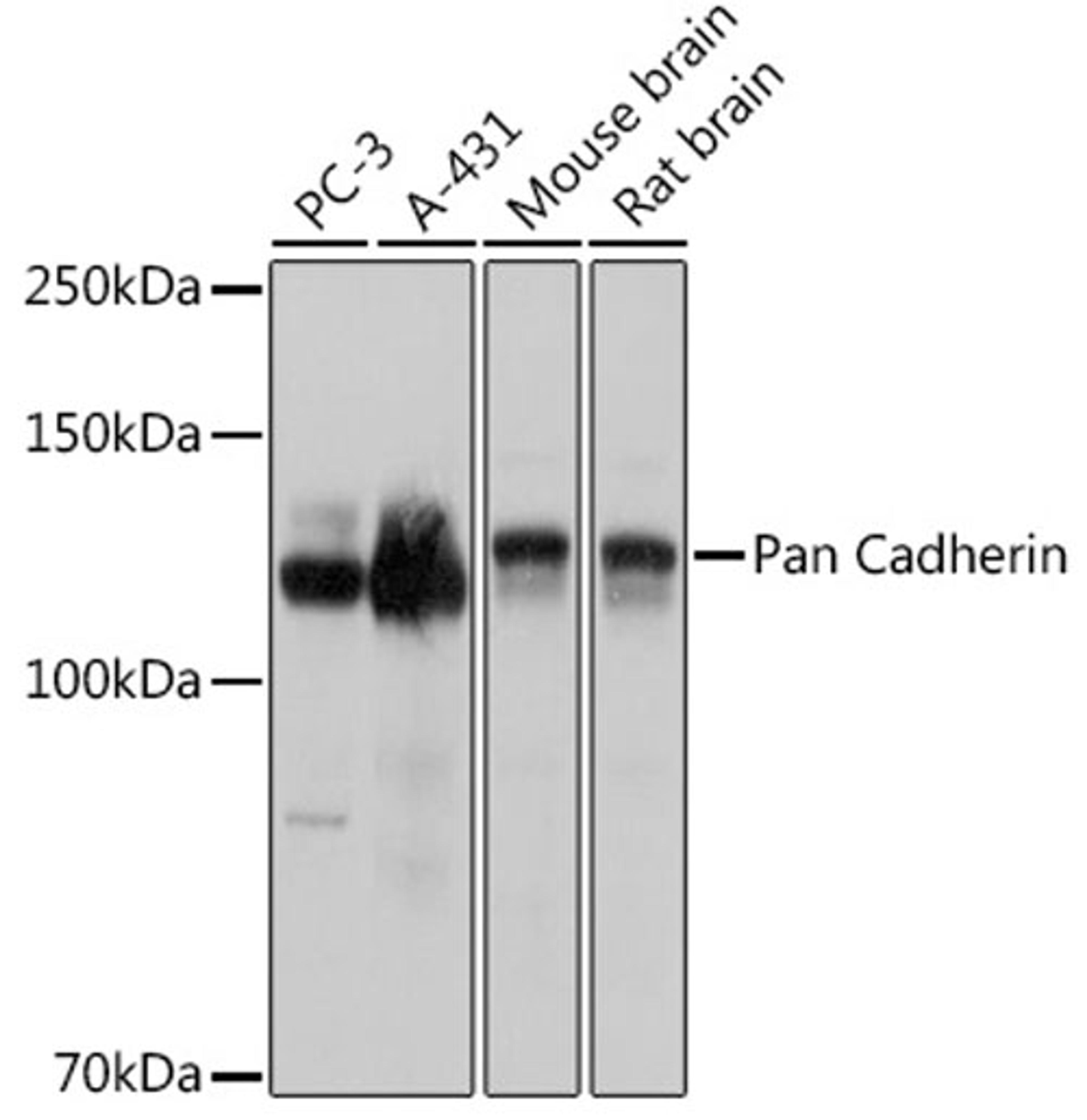 Western blot - Pan Cadherin antibody (A18682)