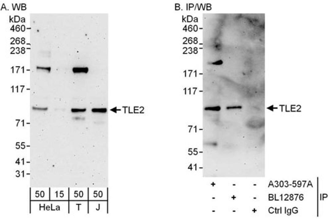 Detection of human TLE2 by WB and IP.